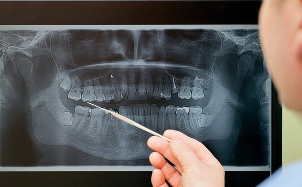 Рентгенодиагностика в стоматологии