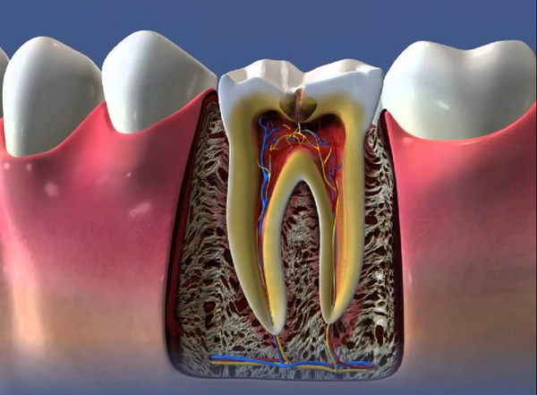 Почему корень разрушенного зуба нужно своевременно удалять