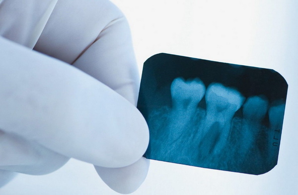 Диагностические методы в стоматологии