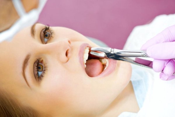 Какие стоматологические проблемы считаются более распространёнными и можно ли их избежать