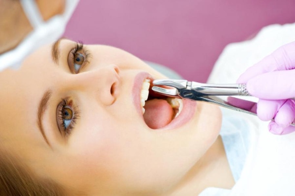 Удаление зуба: подготовка и противопоказания