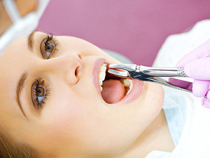 Удаление зубов: причины и особенности