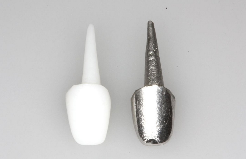 Культевая вкладка на зуб - Стоматология «НоваДэнт»